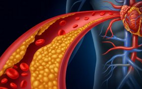 Uno de cada tres argentinos tiene niveles elevados de un tipo de colesterol genético