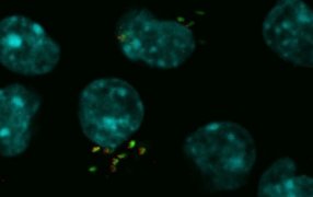 Brucelosis bovina: Un hallazgo científico podría ser clave para frenar la enfermedad