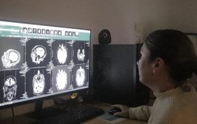 Posadas: El Hospital Dr. Ramón Madariaga realiza la innovadora cirugía de epilepsia receptiva, de desconexión y terapia de inmunomodulación