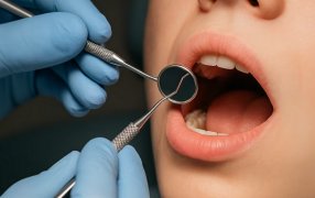 La “epidemia de dientes desalineados”: La mayor parte de la población infantil y adolescente requiere tratamientos de ortodoncia