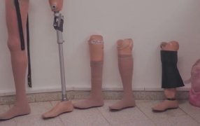 Parque de la Salud de Misiones: El Banco de Prótesis cerró 2025 con 120 entregas y refuerza la cobertura con pacientes de toda la provincia