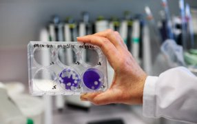 La Administración Nacional de Laboratorios e Institutos de Salud (ANLIS) “Dr. Carlos G. Malbrán”  detectó tres casos de influenza A (H3N2) subclado K en Argentina