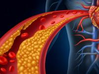 Uno de cada tres argentin