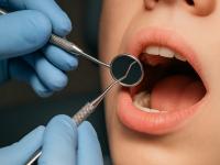 La “epidemia de dientes d