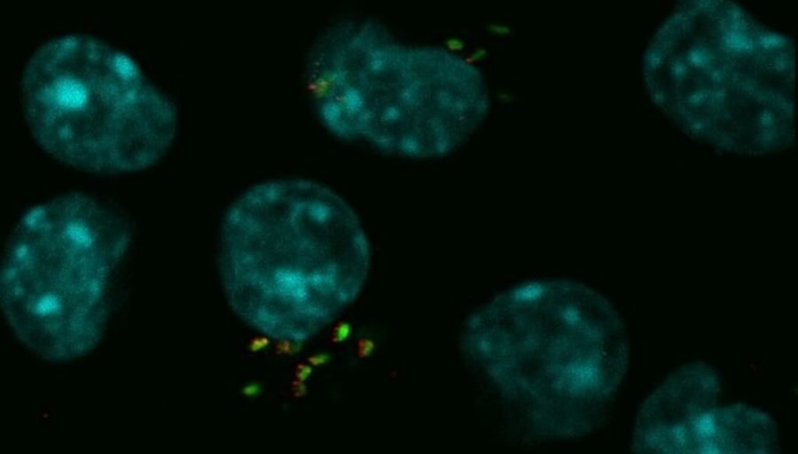 Brucelosis bovina: Un hallazgo científico podría ser clave para frenar la enfermedad