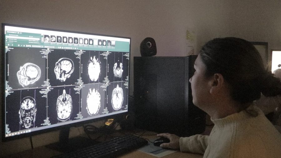 El Hospital Dr. Ramón Madariaga en la ciudad de Posadas advierte sobre los principales factores de riesgos del ACV y la importancia de la detección temprana