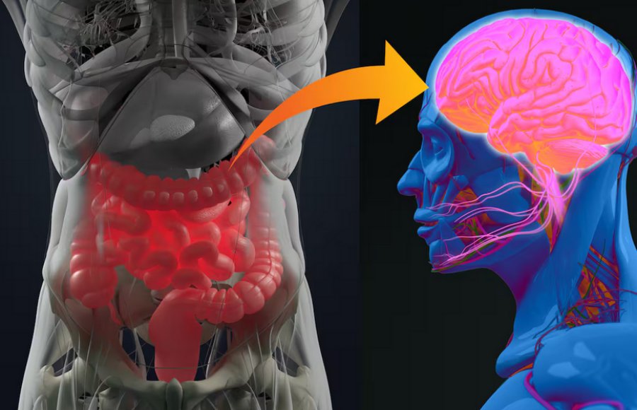 ¿Niebla mental?: Puede estar en tu intestino, los científicos siguen aprendiendo más sobre la conexión entre el cerebro y el sistema digestivo